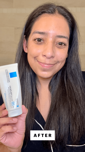 Foresto after applying the La RochePosay Cicaplast Baume B5