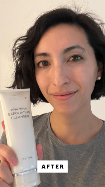 Pai after applying SkinMedica's AHA  BHA Exfoliating Cleanser